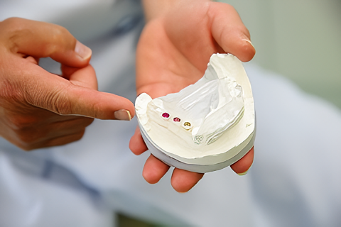 目立たない矯正治療で自信ある笑顔をサポート