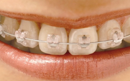 美しく健康的な歯並びを目指します