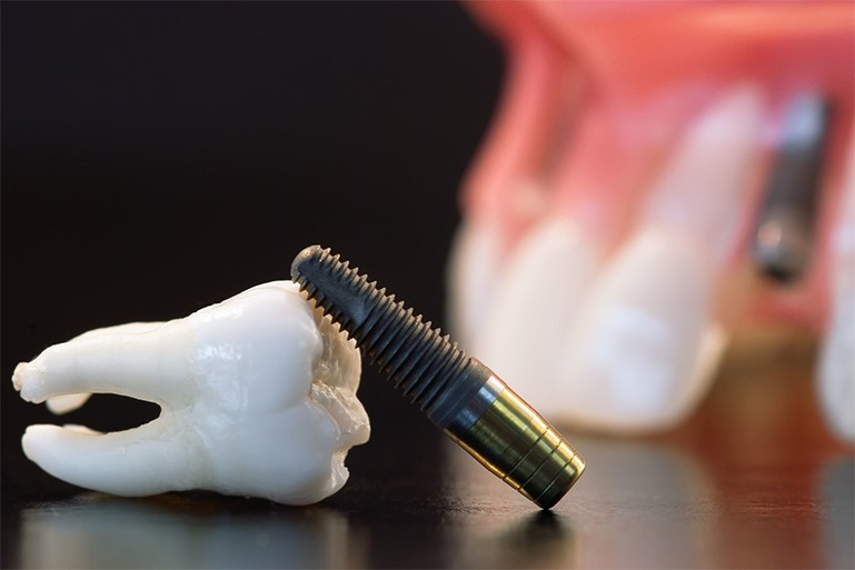 ※画像はイメージです。