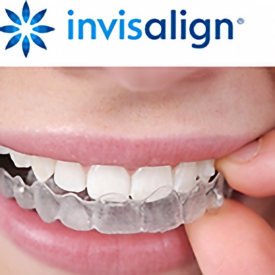 インビザラインシステムを導入