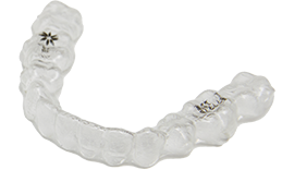 取り外し可能で目立ちにくい装置を使い、快適な矯正治療を実現