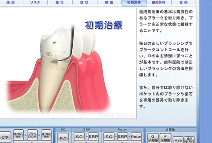 モニターでわかりやすく説明