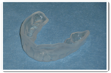 マウスガードにより脳を守ることもできます