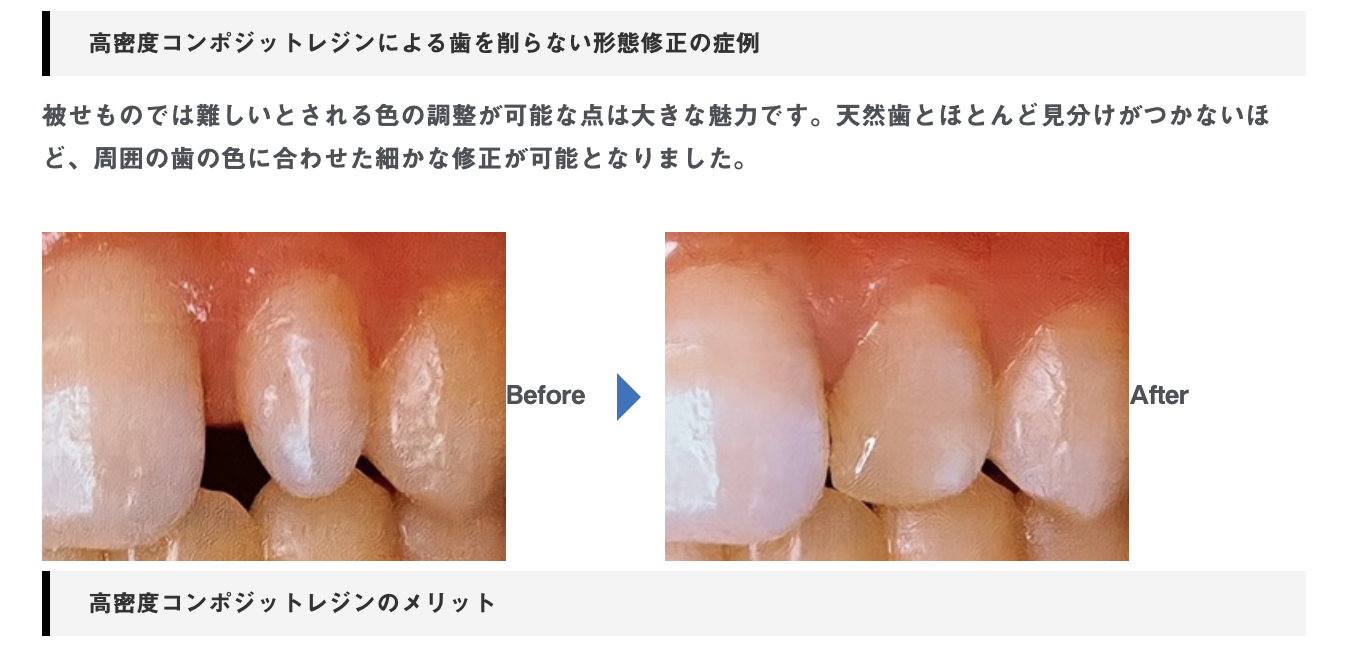 金属を使用しない「メタルフリー治療」を提供しています