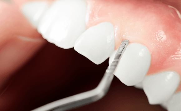 全身疾患との関連性を考慮した予防と治療で健康な口腔環境を維持