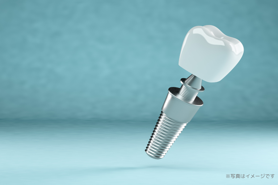 インプラント治療を行い、歯を失った方の機能回復をサポートしています