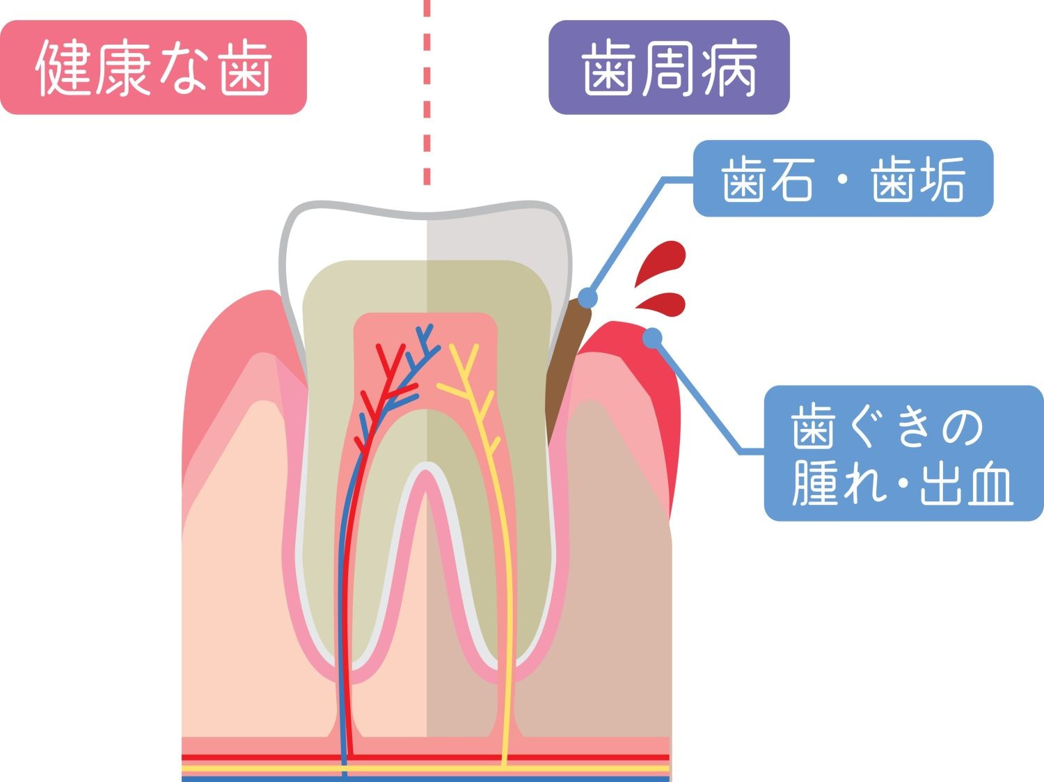 写真はイメージです