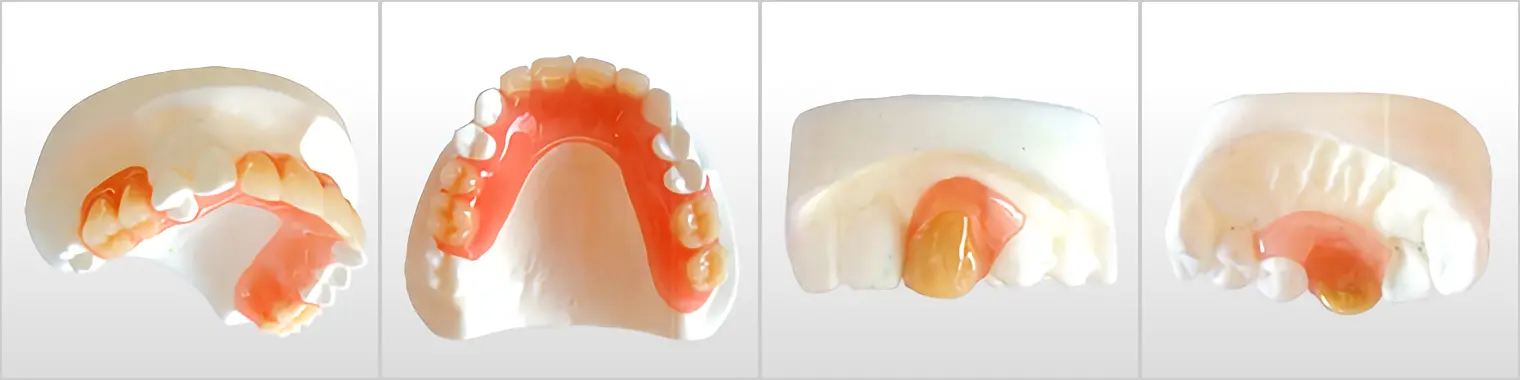 大部分の歯が失われた場合の総入れ歯と、部分的に歯を失った場合の部分入れ歯の両方に対応しています
