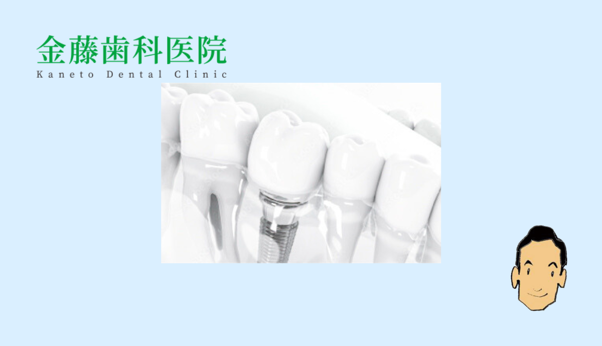 インプラントで快適な噛み心地を