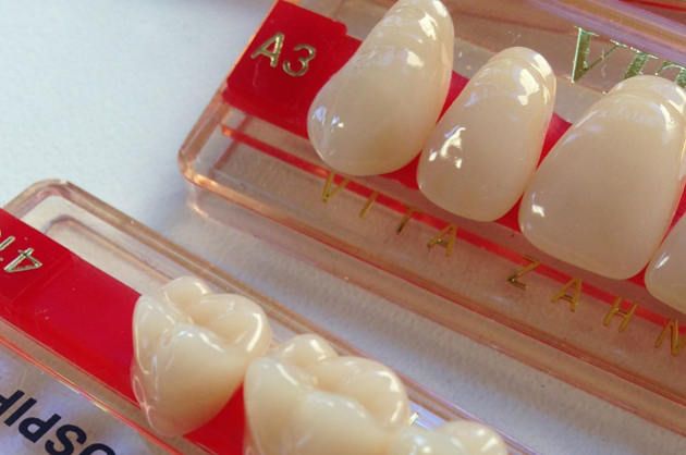 セラミックやジルコニア素材で自然で美しい歯を実現