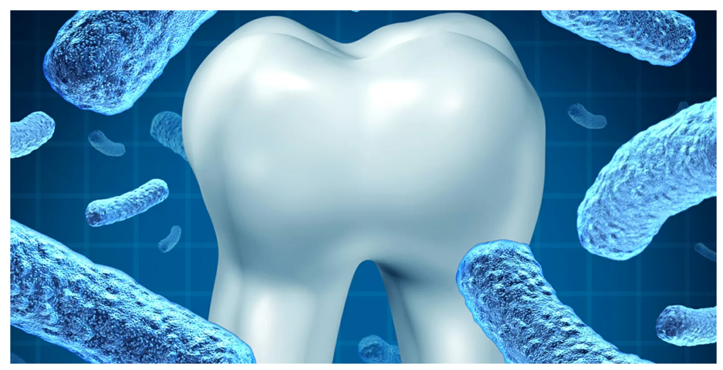 歯の健康を長期的に維持するための重要な治療です