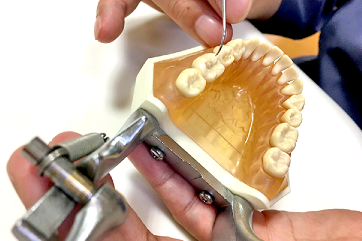 健康な歯ぐきを守る歯周病治療