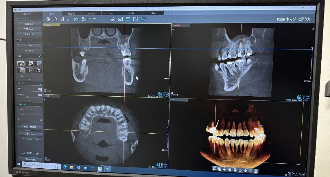 怖くない・痛くない治療を提供