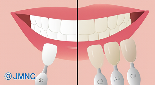 透明感と耐久性を兼ねた自然な口元へ