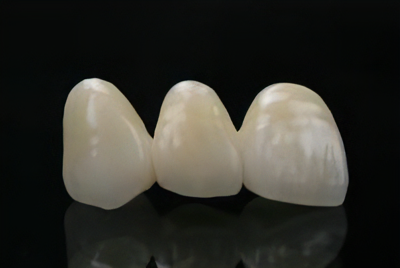 最高の笑顔を提供する審美歯科治療