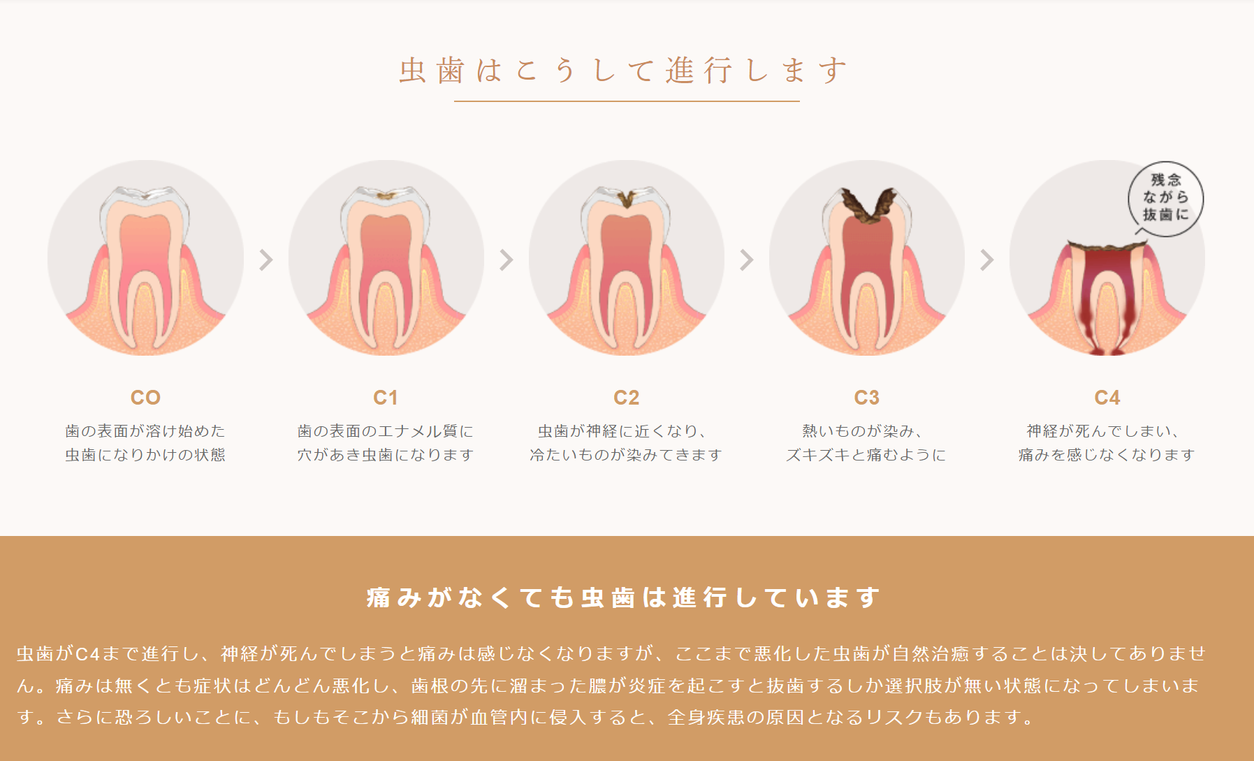 患者様一人ひとりに合わせた予防方法のアドバイスや、口腔ケアの指導も行っております