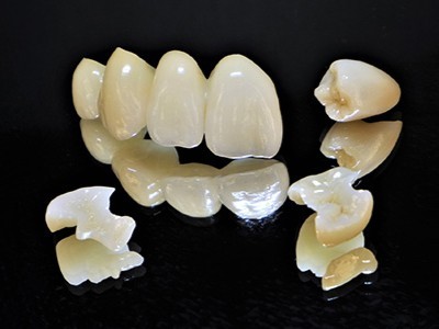 根津歯科医院ではジルコニアを用いたセラミック治療を勧めています