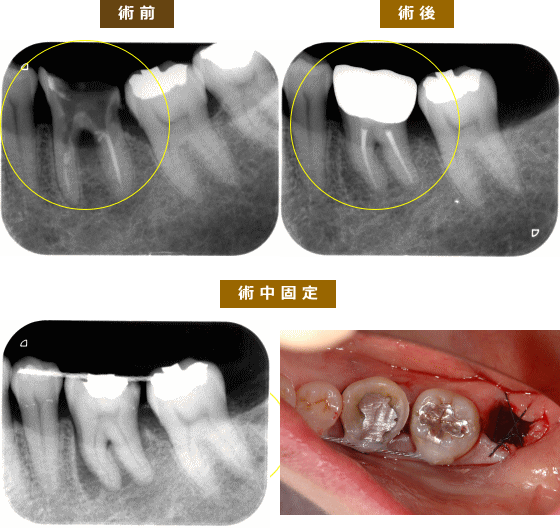 症例
