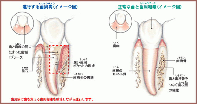 健康な歯の維持をサポートします
