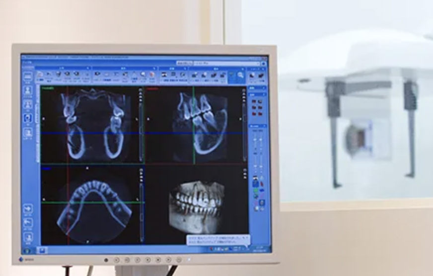 歯を失った時の選択肢にインプラントを勧めています