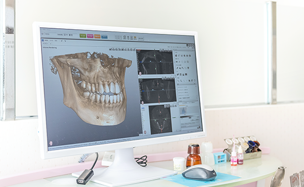 インプラント治療に豊富な経験を持つ山﨑先生が対応