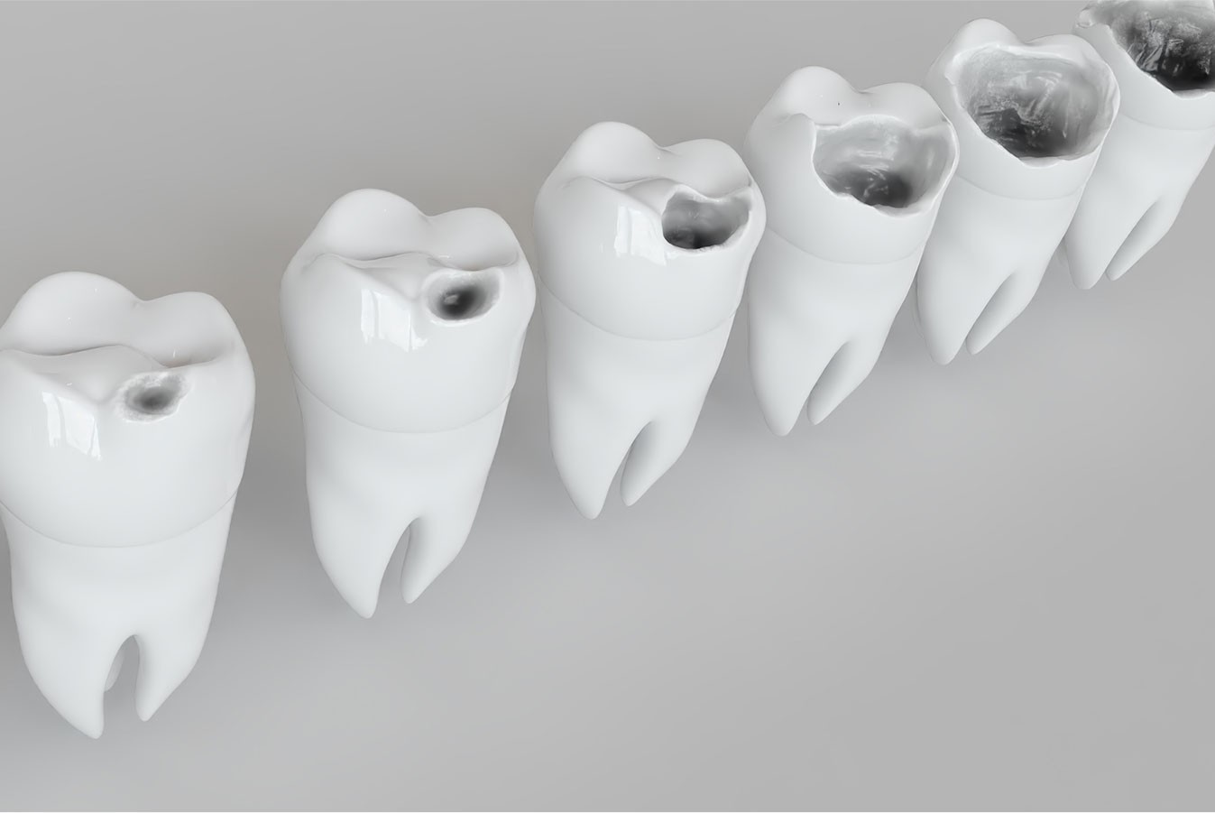 歯科用レーザーも導入しています