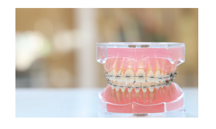 お子さんから成人まで幅広い年齢層に向けた矯正治療を行っています