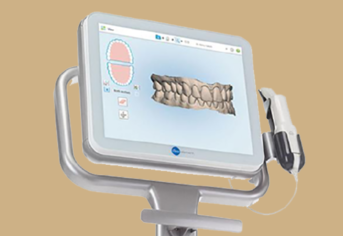 口腔内スキャナー装置「itero element」