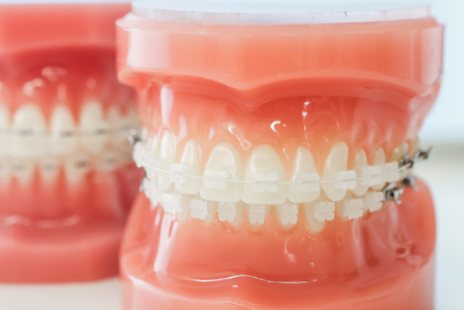 患者様一人一人のニーズに応じた最適な矯正治療を提供し、健康的で自信の持てる笑顔をサポートします。