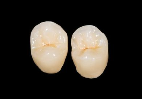 自然な仕上がりを実現するために、最新の技術と素材を用いて、患者様の理想の口元を実現するお手伝いをしています。