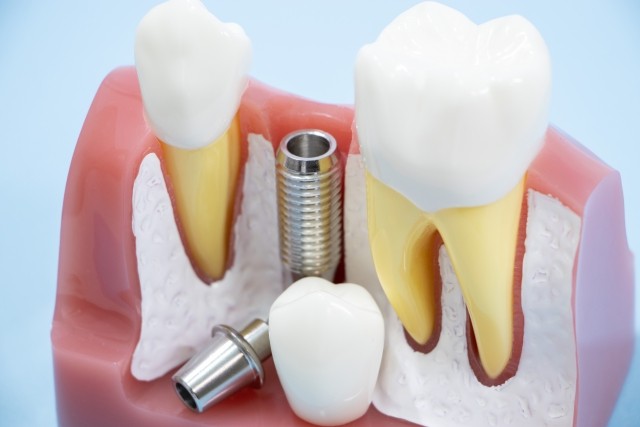 写真はイメージです