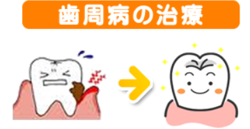 歯周病治療