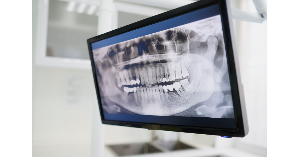 【京都府南丹市】全身管理下での歯科治療に対応する京都中部総合医療センター