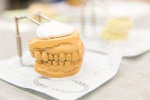 保険・自費の選択肢を用意し、生活に合った義歯の提案を実施