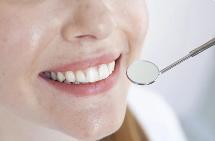 白く美しい歯は自信が持てます