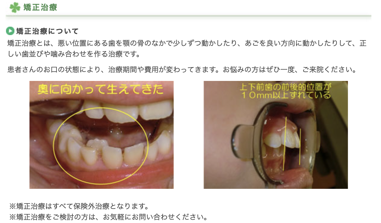 歯並びや噛み合わせのお悩みに対応するため、矯正治療を提供しています
