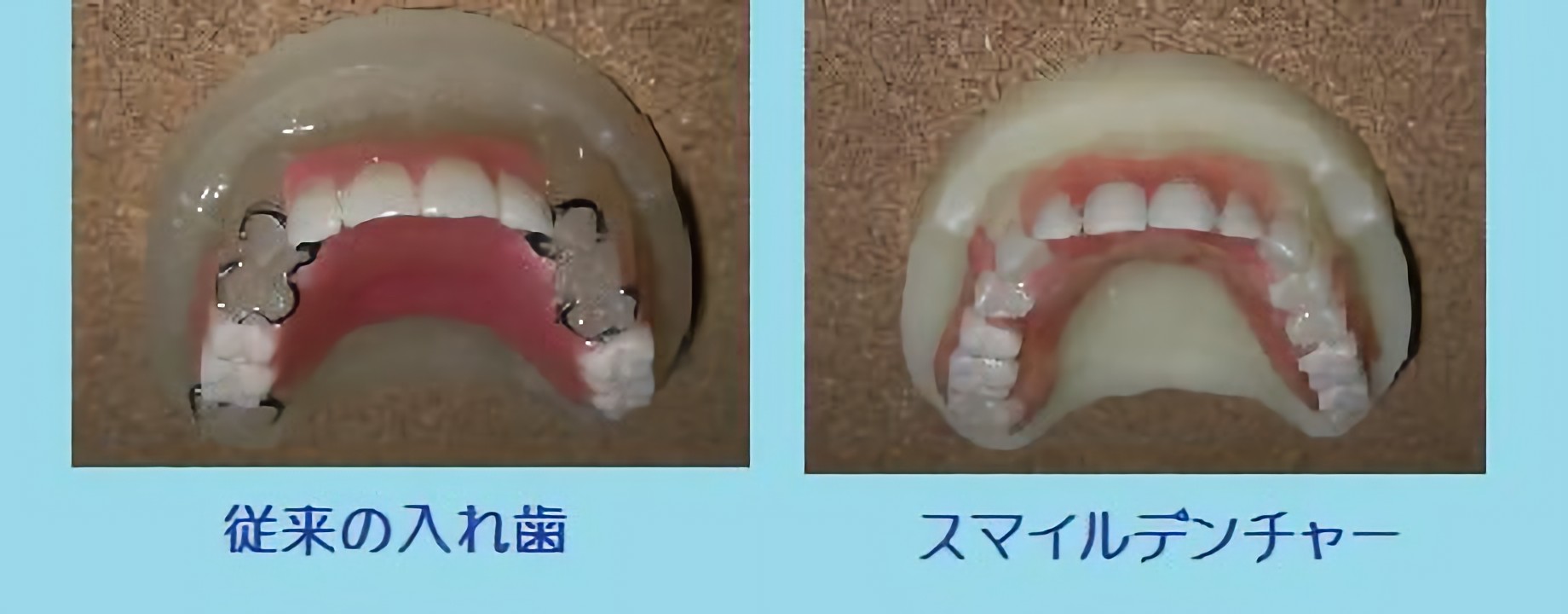 快適な入れ歯をご提案します