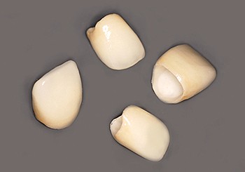 補綴物の精度を左右する型取りの工程を大切にしています。