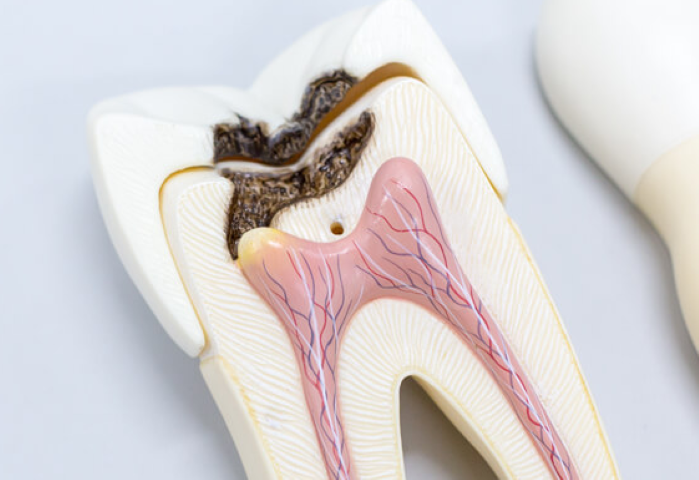 できるだけ痛みを抑えた丁寧な一般歯科治療