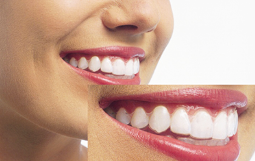 デジタル技術と専門医の技術で、理想的な歯列を実現します