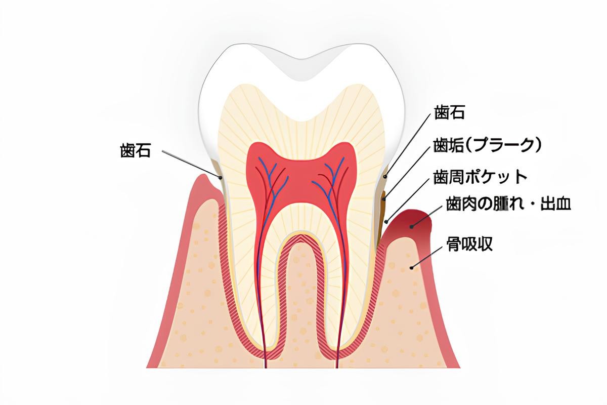 早期発見・早期治療が大切です