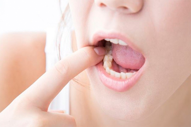 できる限り歯を残すことを基本方針としつつ、状態に応じた最適な治療を提案しています。