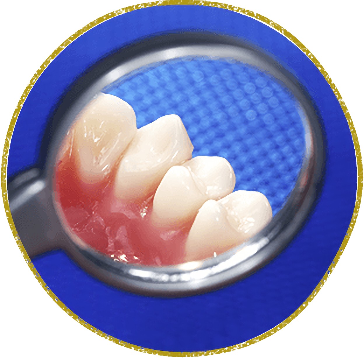 早期の対処が大切です