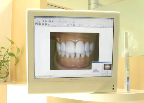 口腔内カメラで説明が分かりやすい