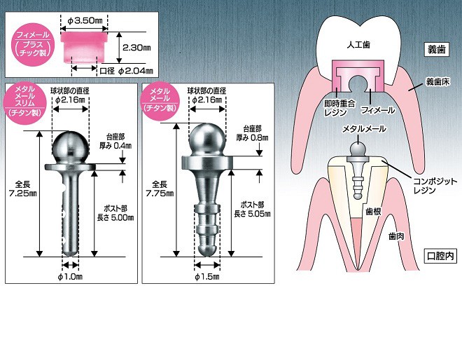 装着感の良い有床義歯を作成することが出来ます