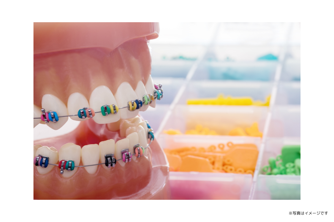 噛み合わせのバランスや将来的な健康面まで考慮した矯正治療が行われています
