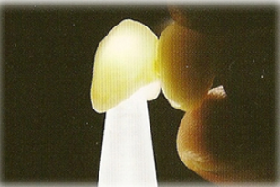 審美性、割れにくさにすぐれたジルコニア