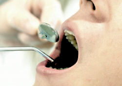 年齢に合わせた色調と形状で理想の口元を実現