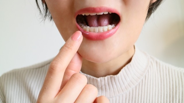 自信が持てる白い歯に