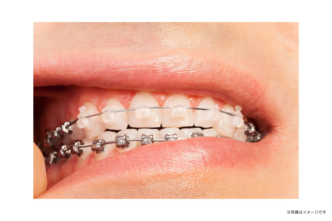 【夙川駅徒歩1分】早朝診療に対応する矯正・一般歯科の夙川グリーンタウン矯正歯科クリニック